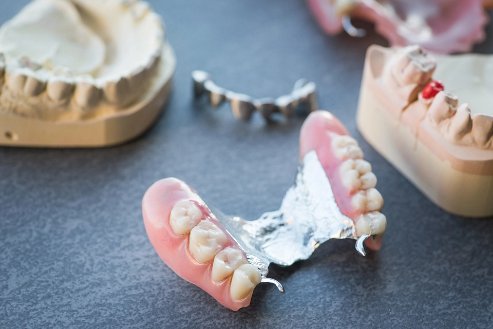 The Fitting and Adjustment Process of Dentures: Stages and Importance