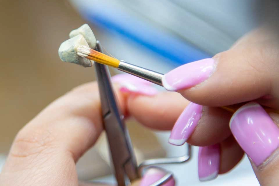 Fabrication and Installation of Crowns for Dental Implants