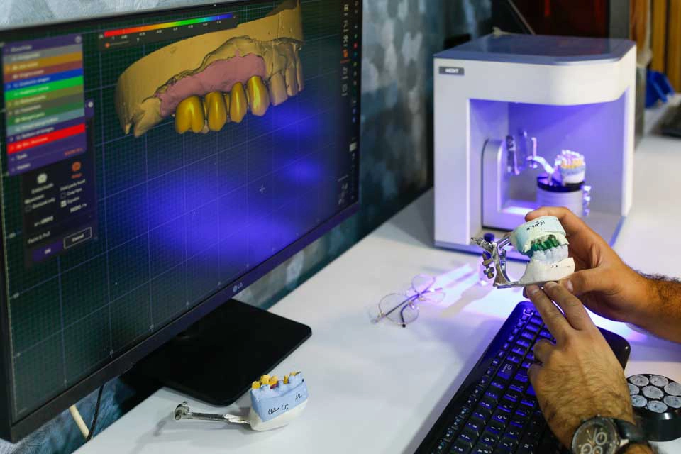 CAD/CAM Fabrication and Installation of Crowns for Dental Implants دندانسازی دیجیتال