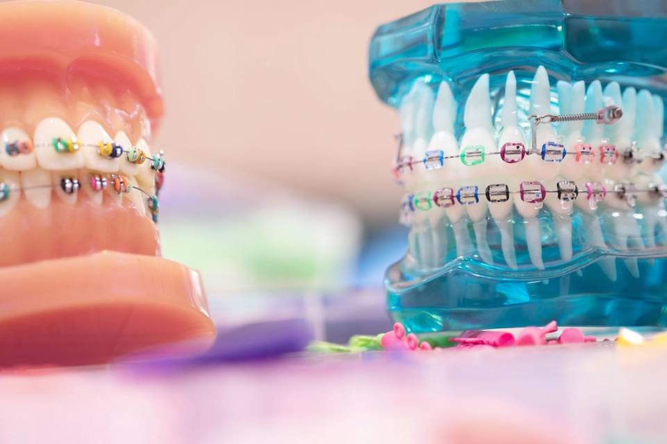 Orthodontic Services: A Solution for Smile Correction and Enhancement