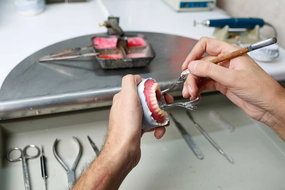 Dental Impressions: The Process and Its Importance in Dentistry